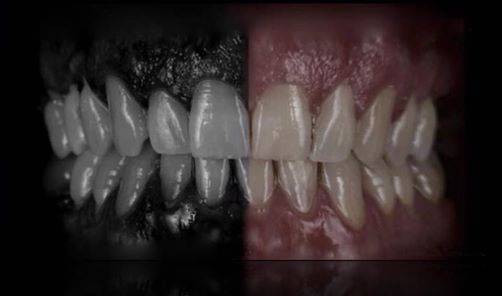 Ecco un piccolo trucco per raggiungere l'estetica Top! - Michele Orefice