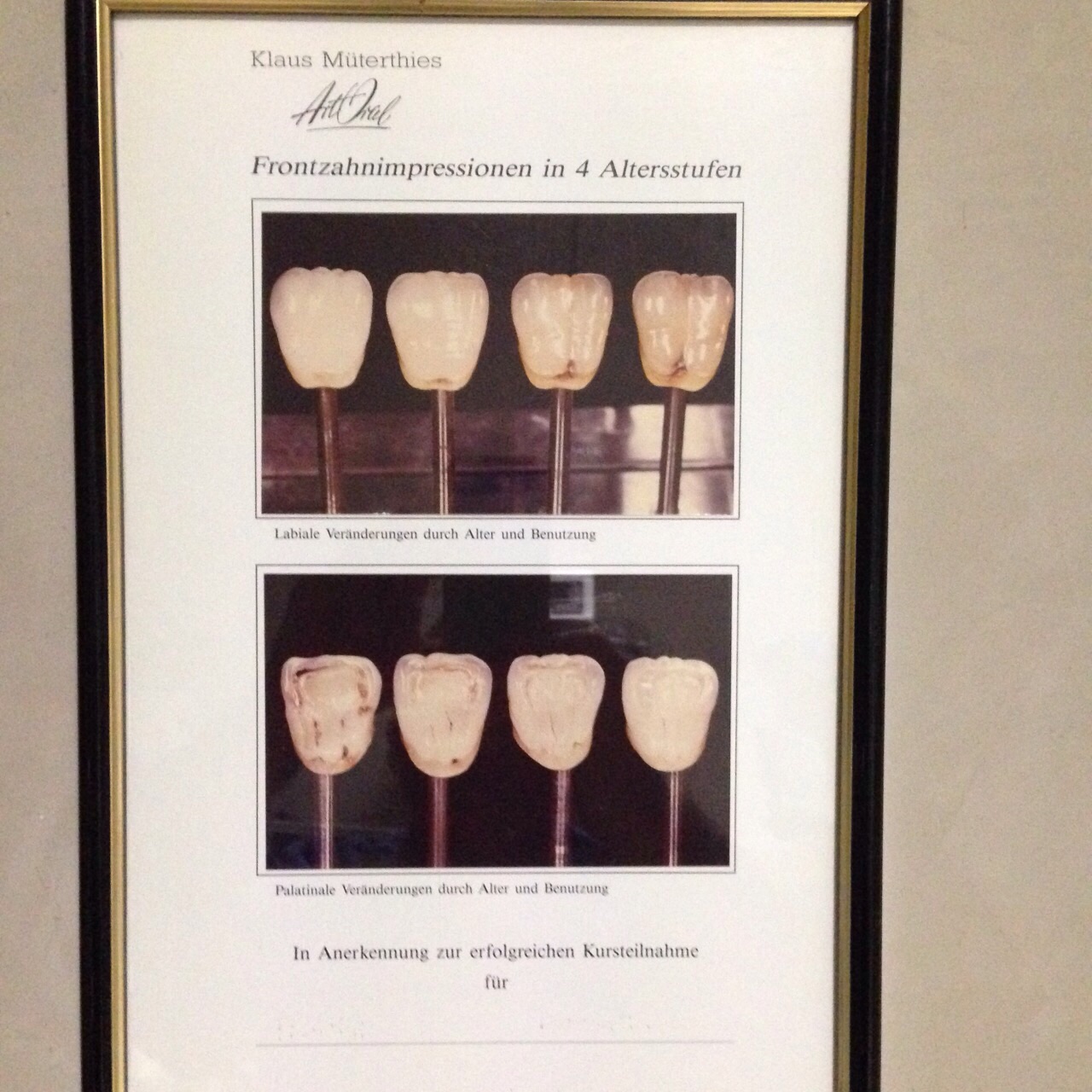 Pierluigi Durante - Italia